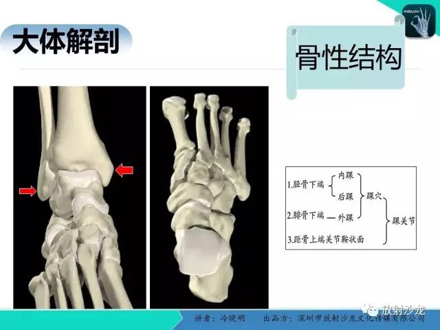 【PPT】基于损伤机制的踝关节急性损伤的影像学评估