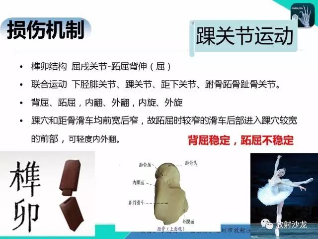 【PPT】基于损伤机制的踝关节急性损伤的影像学评估