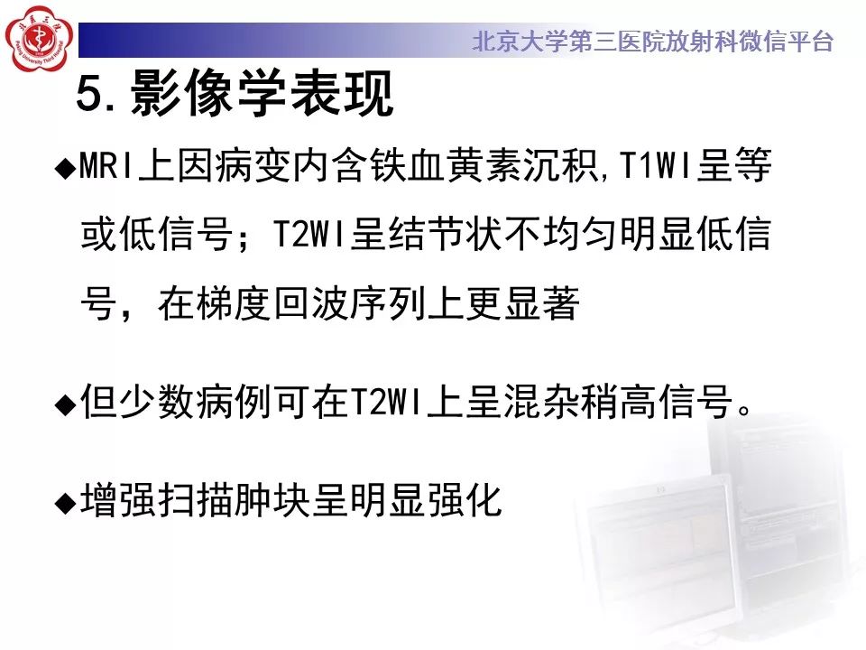 【病例】脊柱腱鞘巨细胞瘤1例CT及MR影像诊断