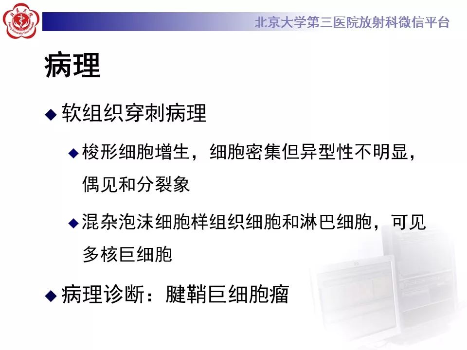 【病例】脊柱腱鞘巨细胞瘤1例CT及MR影像诊断