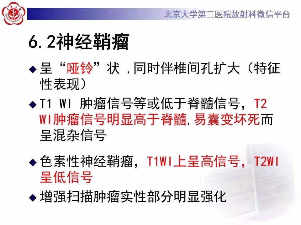 【病例】脊柱腱鞘巨细胞瘤1例CT及MR影像诊断