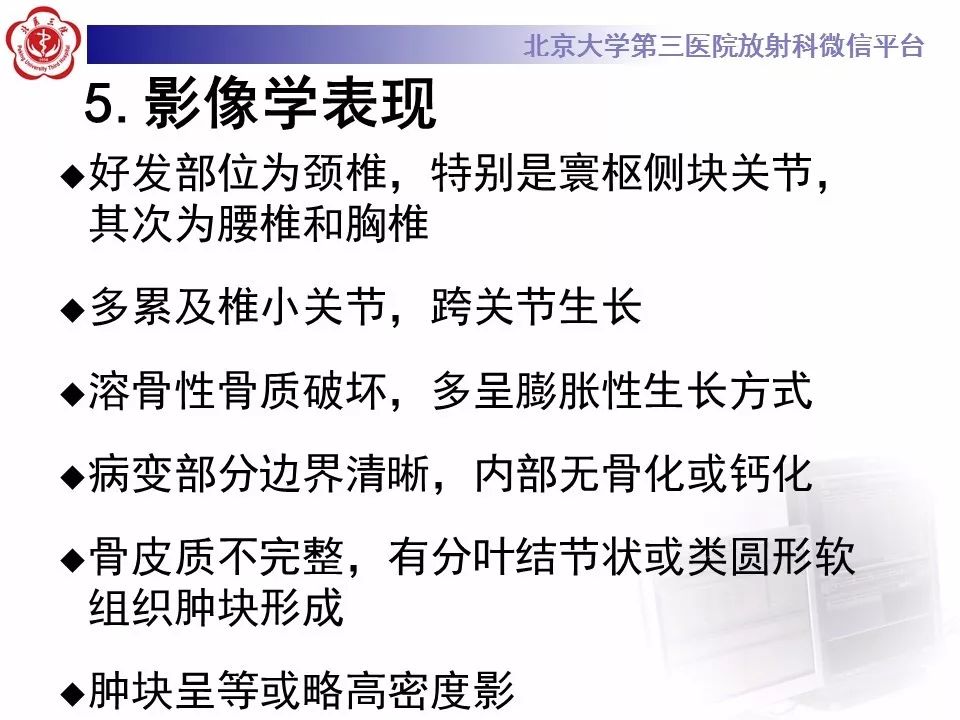 【病例】脊柱腱鞘巨细胞瘤1例CT及MR影像诊断