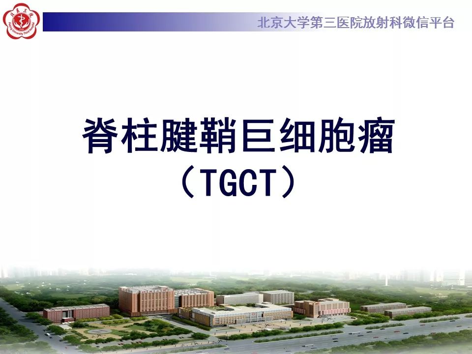 【病例】脊柱腱鞘巨细胞瘤1例CT及MR影像诊断