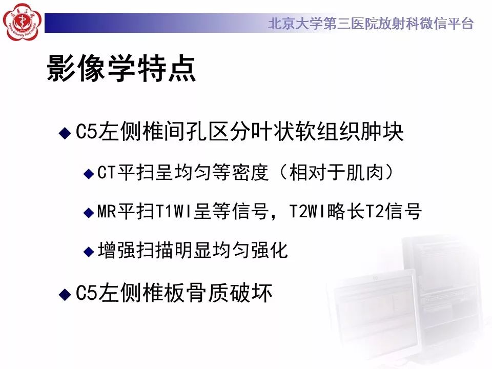 【病例】脊柱腱鞘巨细胞瘤1例CT及MR影像诊断