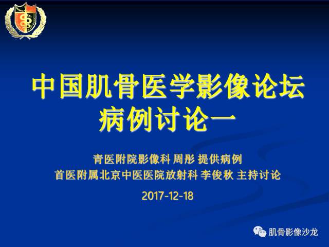 【病例】骨淋巴瘤及软骨肉瘤两例CT及MR影像表现