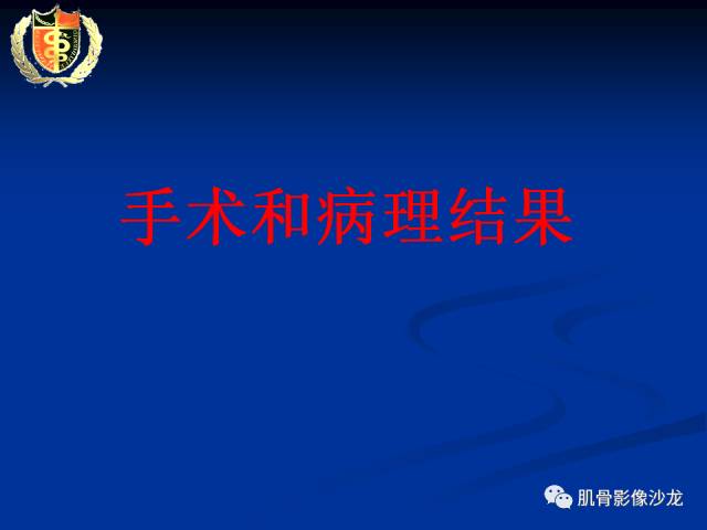 【病例】骨淋巴瘤及软骨肉瘤两例CT及MR影像表现