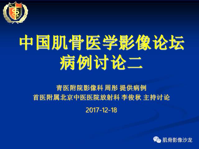 【病例】骨淋巴瘤及软骨肉瘤两例CT及MR影像表现