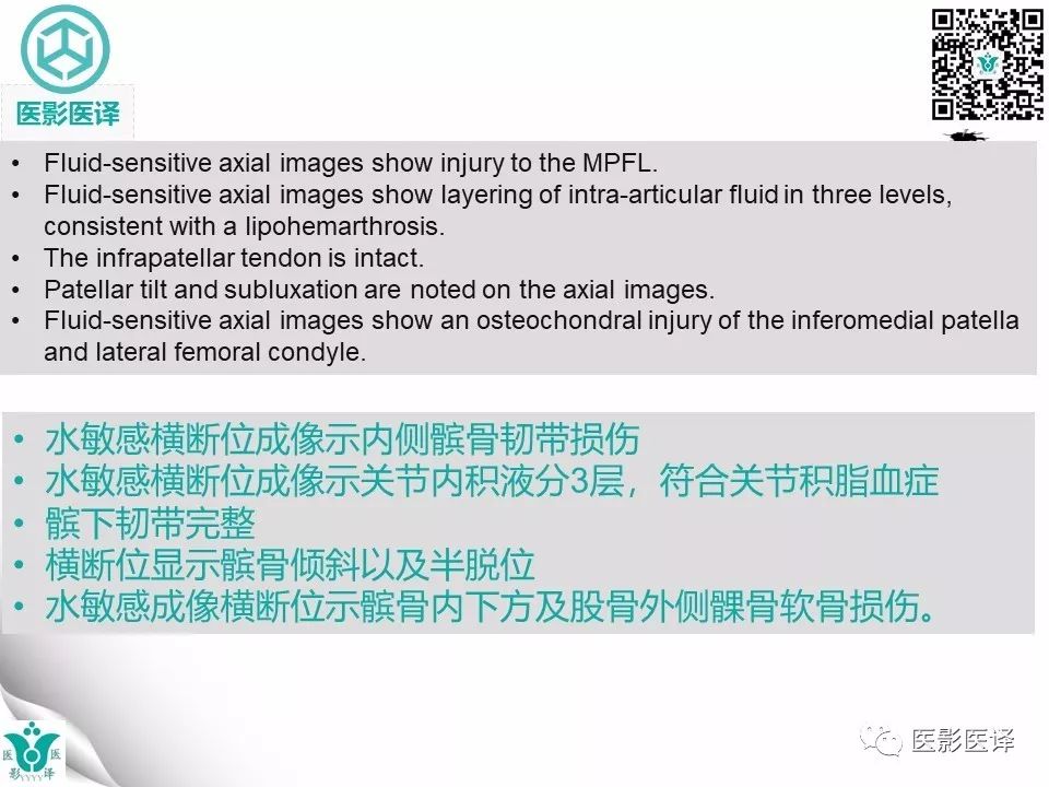 【病例】急性滑脱性髌股撞击症1例X线MR