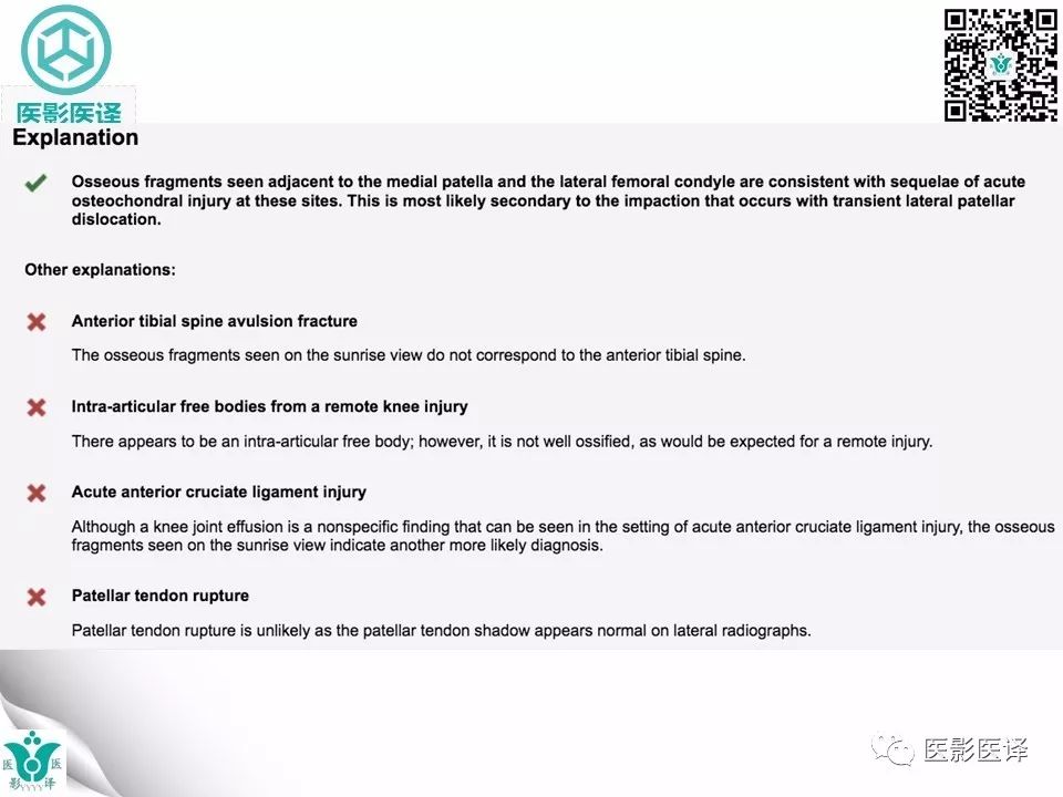 【病例】急性滑脱性髌股撞击症1例X线MR
