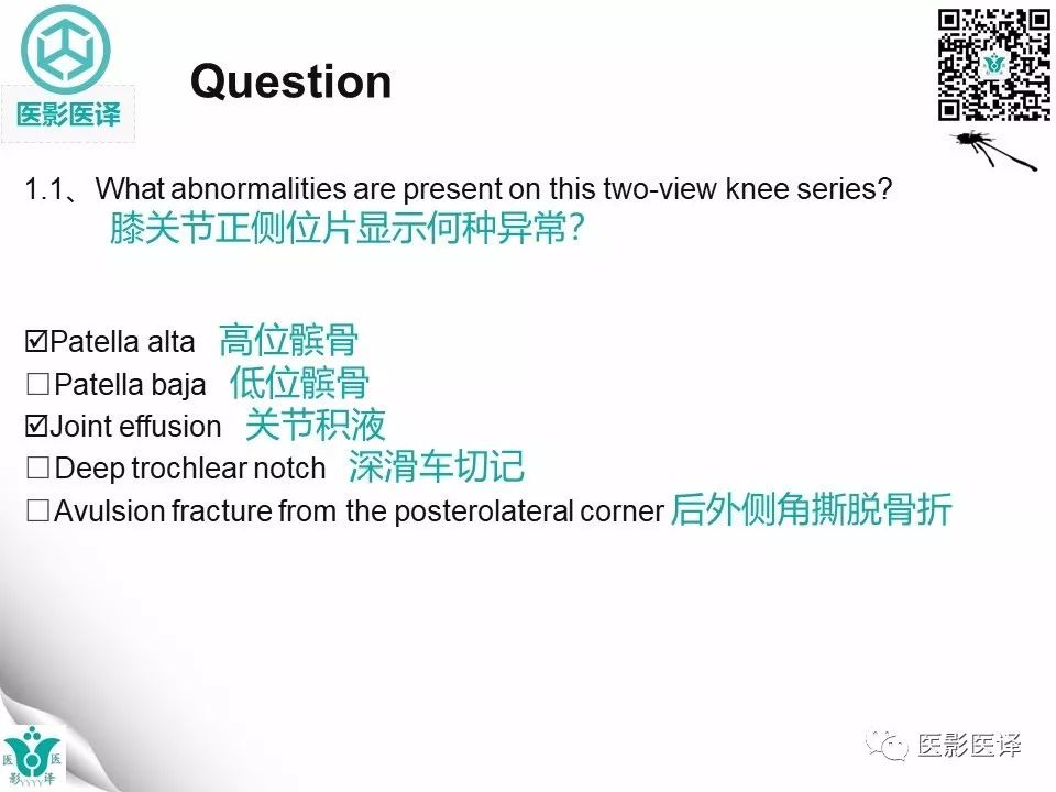 【病例】急性滑脱性髌股撞击症1例X线MR