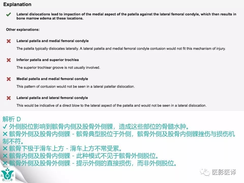 【病例】急性滑脱性髌股撞击症1例X线MR