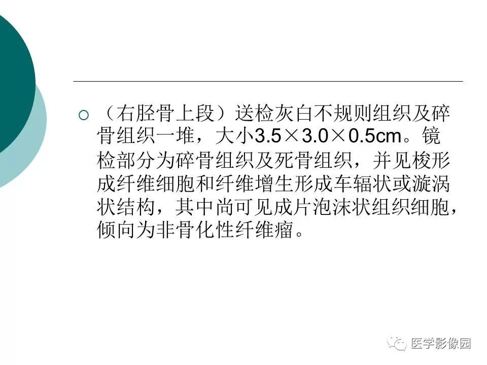 【病例】胫骨非骨化性纤维瘤1例CT及MR