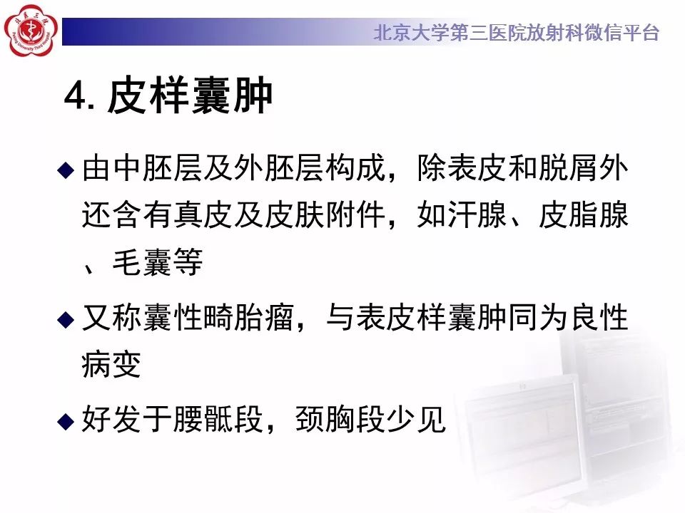 【病例】椎管内髓外硬膜下畸胎瘤1例