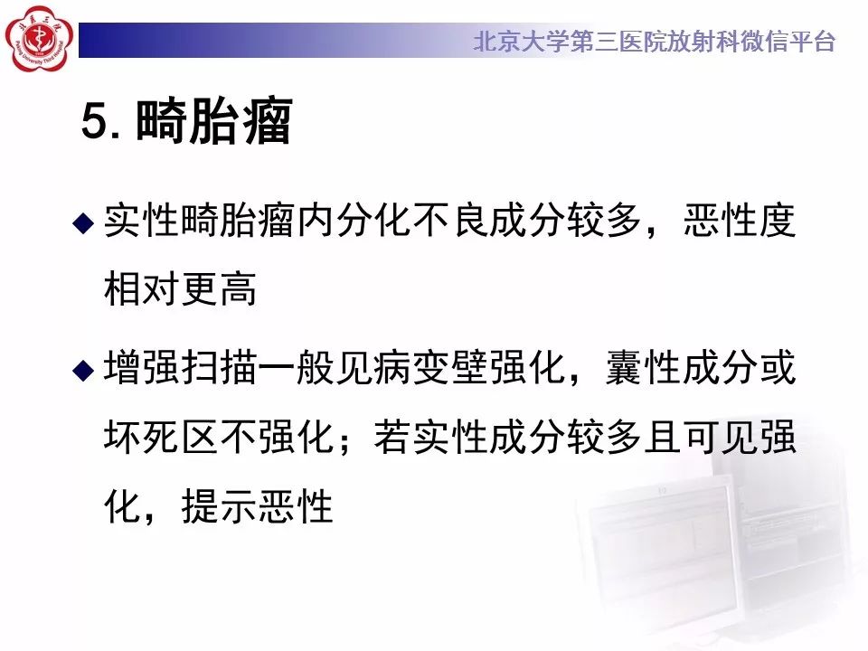 【病例】椎管内髓外硬膜下畸胎瘤1例