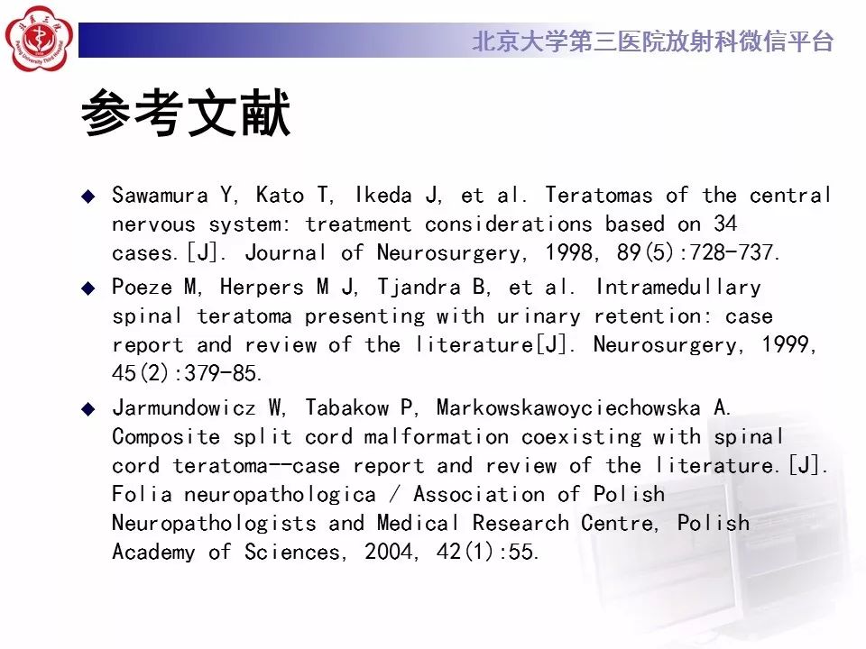 【病例】椎管内髓外硬膜下畸胎瘤1例