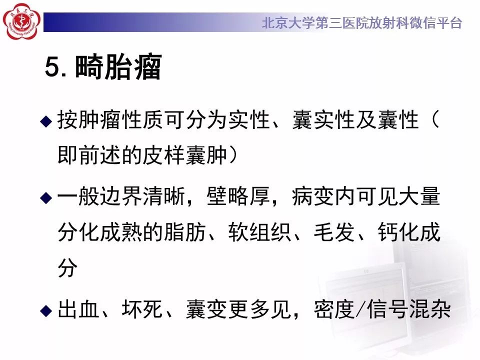 【病例】椎管内髓外硬膜下畸胎瘤1例