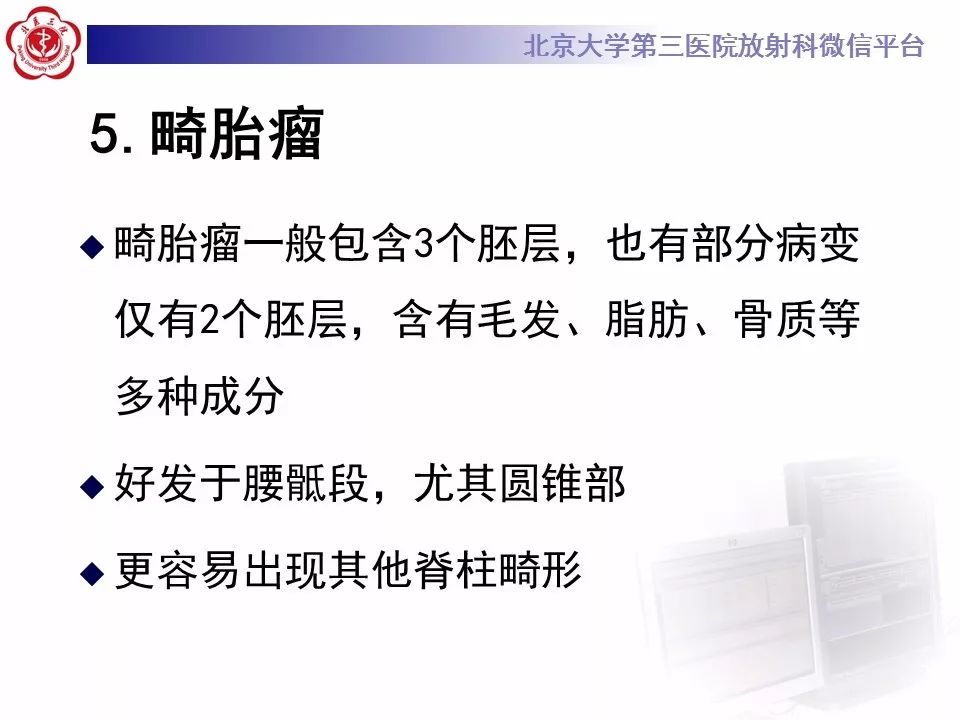 【病例】椎管内髓外硬膜下畸胎瘤1例