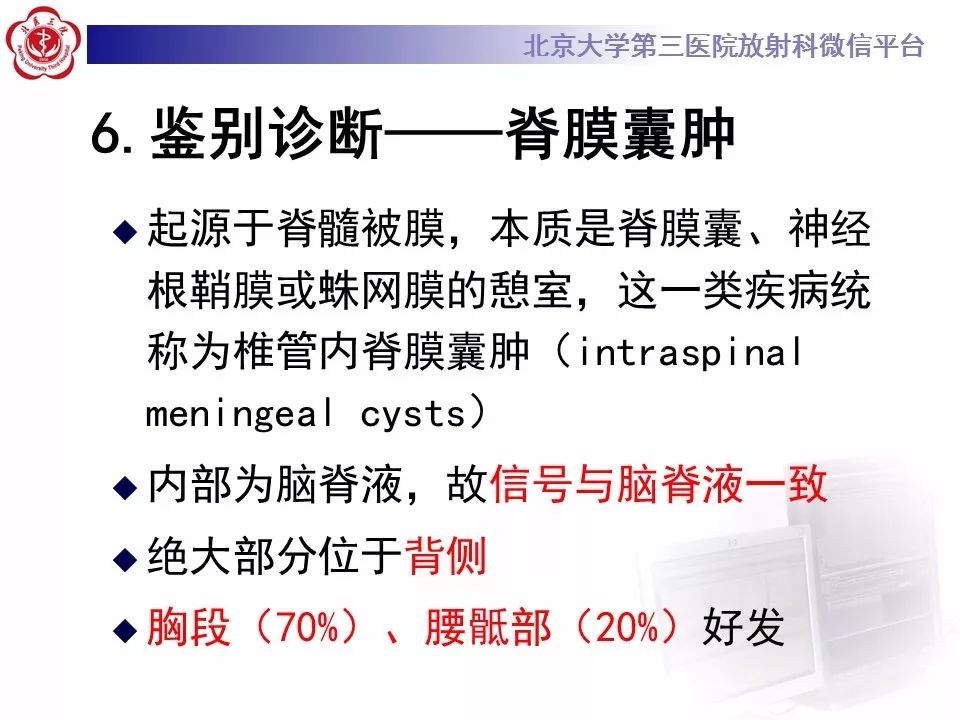 【病例】椎管内髓外硬膜下畸胎瘤1例