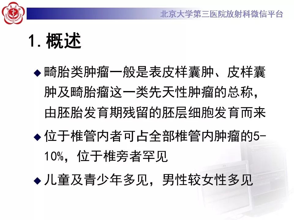 【病例】椎管内髓外硬膜下畸胎瘤1例