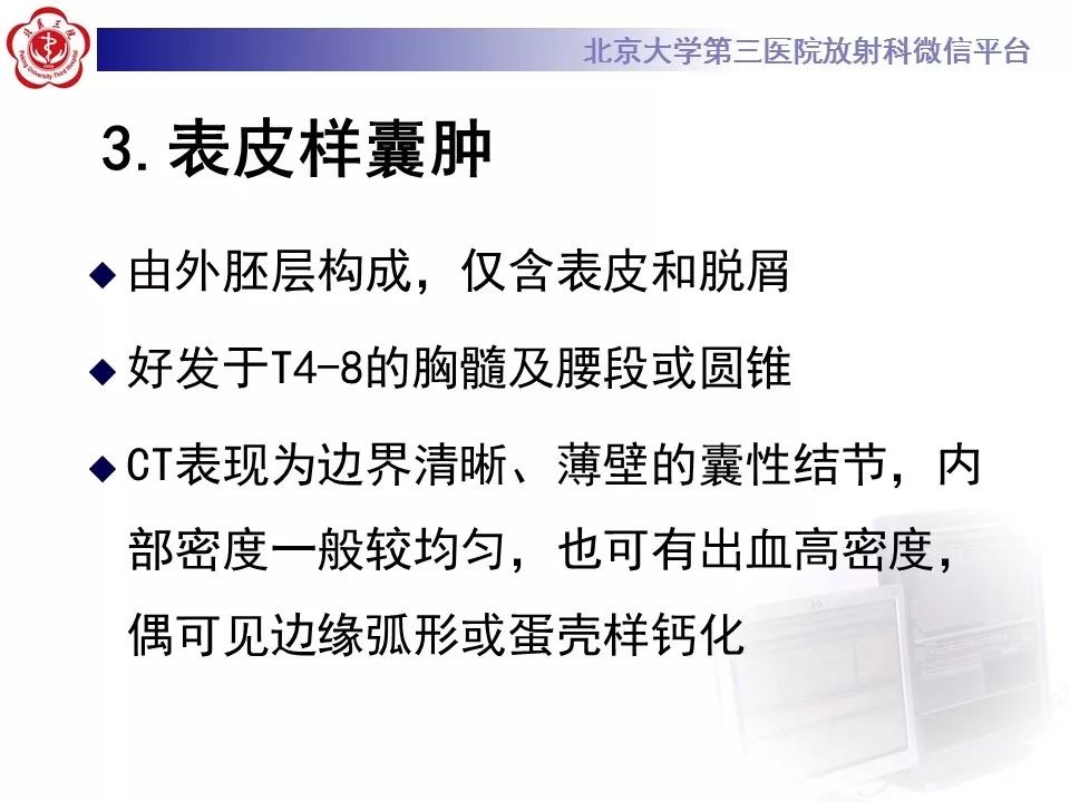 【病例】椎管内髓外硬膜下畸胎瘤1例