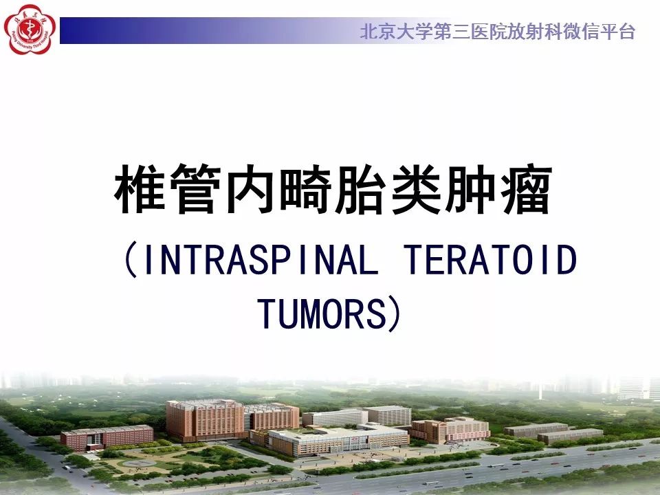 【病例】椎管内髓外硬膜下畸胎瘤1例