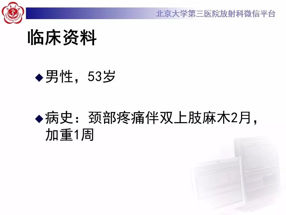 【病例】椎管内髓外硬膜下畸胎瘤1例
