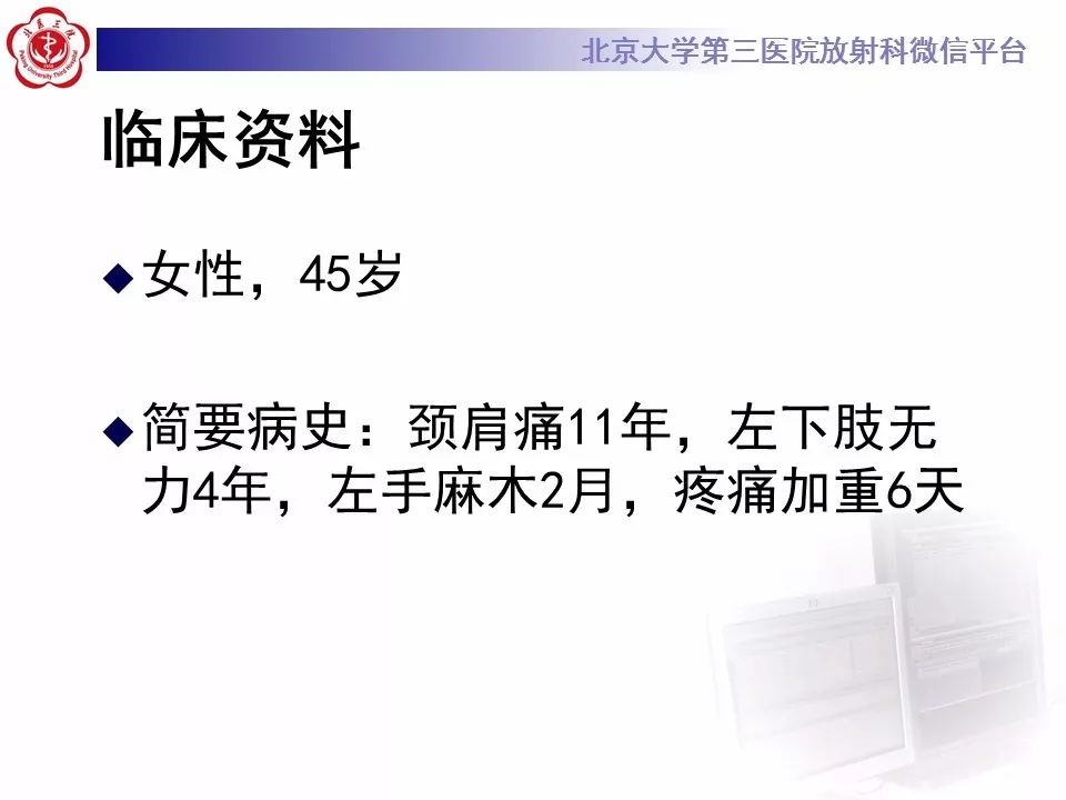 【病例】颈椎椎管内节细胞神经瘤1例MR