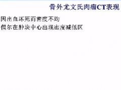 椎管内原始神经外胚层肿瘤1例CT及MR