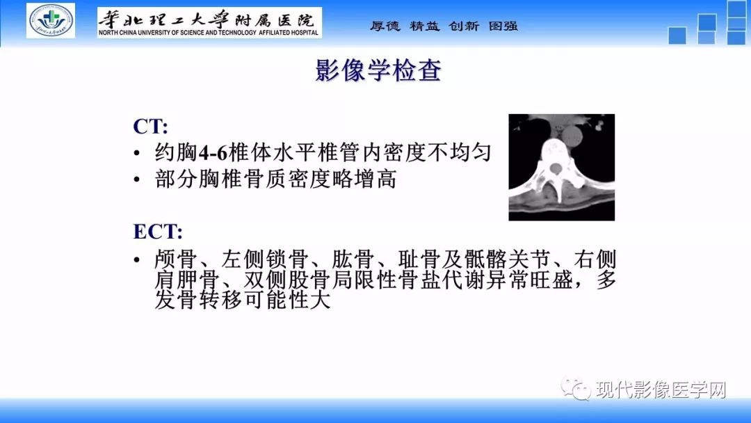 【病例】椎管内原始神经外胚层肿瘤1例CT及MR