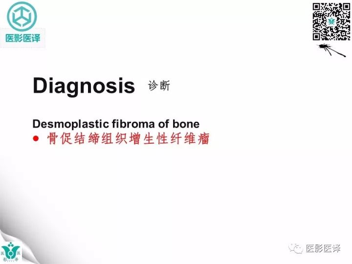 【病例】骨促结缔组织增生性纤维瘤1例X线MR