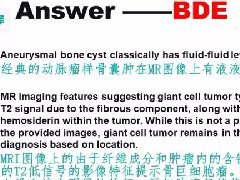 骨促结缔组织增生性纤维瘤1例X线MR