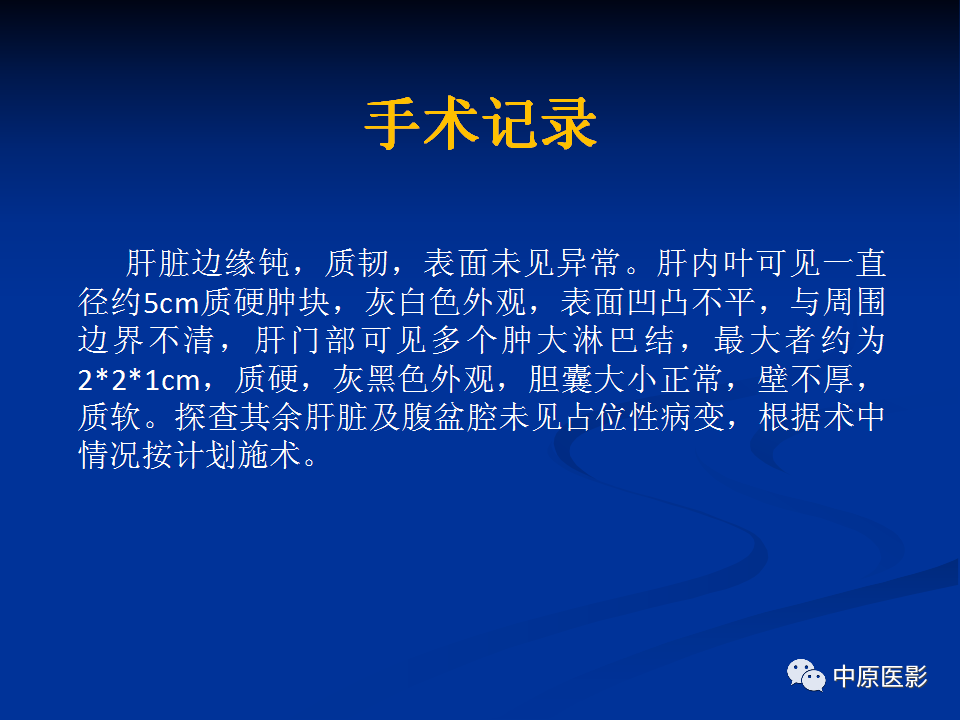 【病例】肝脏胆管细胞癌1例MR影像-13