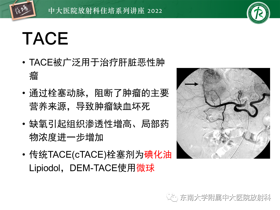 【PPT】肝癌介入治疗后的磁共振评估-3