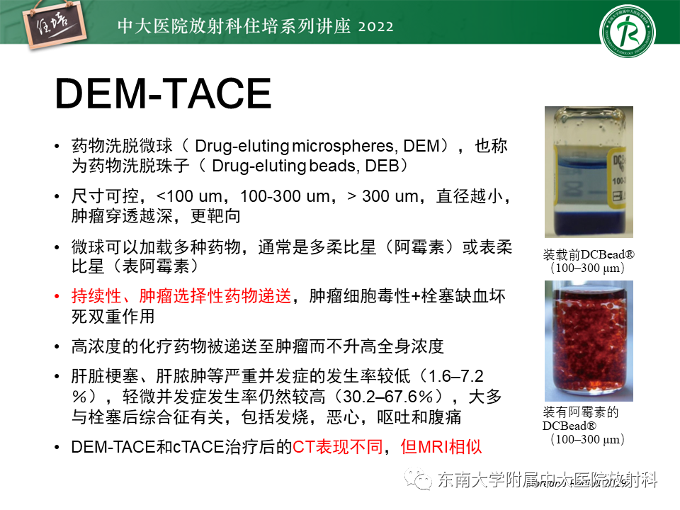 【PPT】肝癌介入治疗后的磁共振评估-4