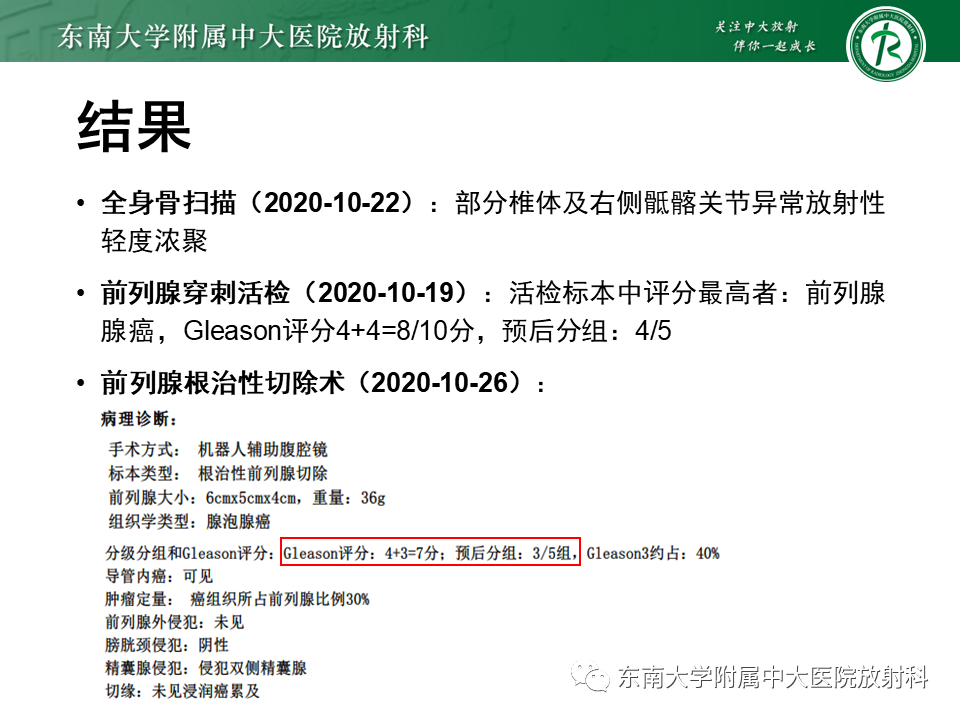 【PPT】前列腺癌-20