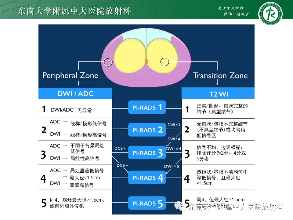 【PPT】前列腺癌-15