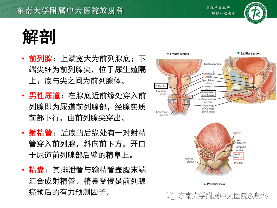 【PPT】前列腺癌-9