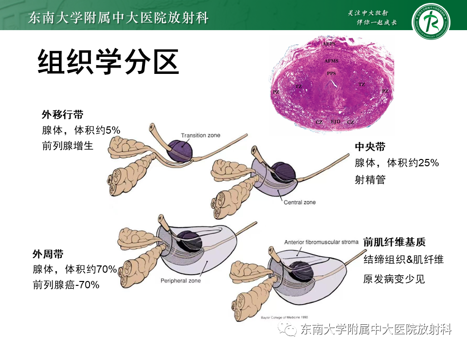 【PPT】前列腺癌-10