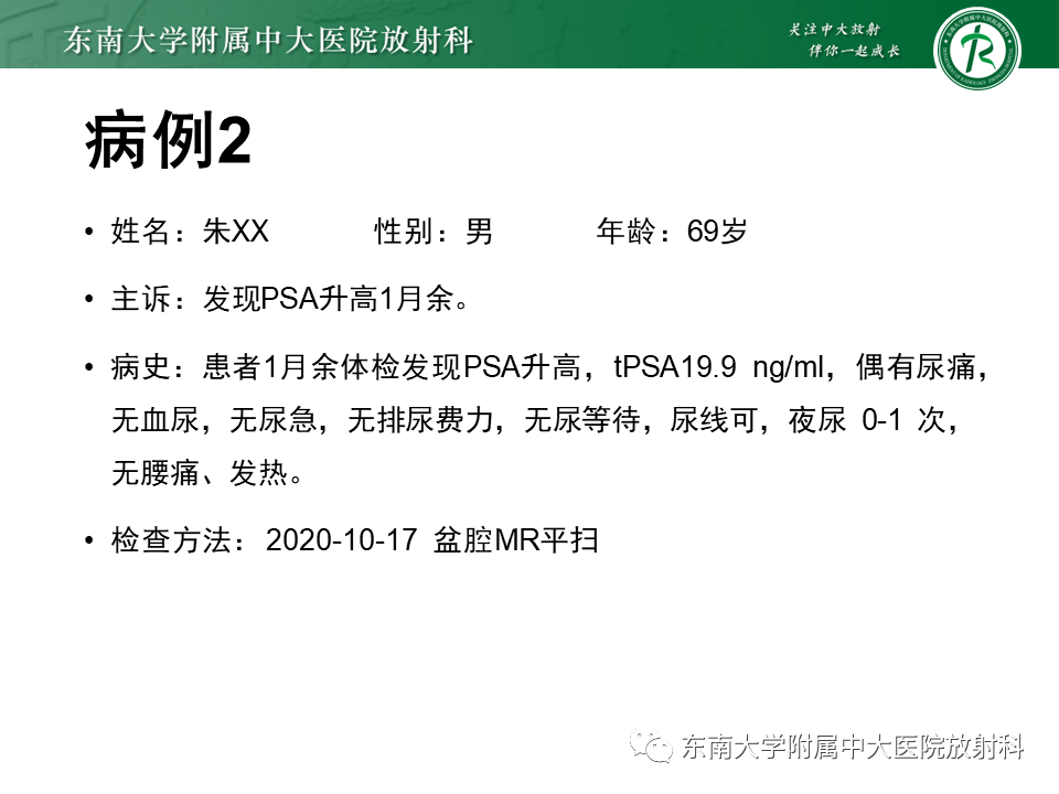 【PPT】前列腺癌-17