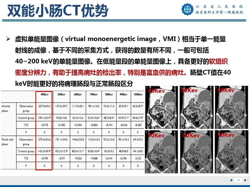 【PPT】克罗恩病-46