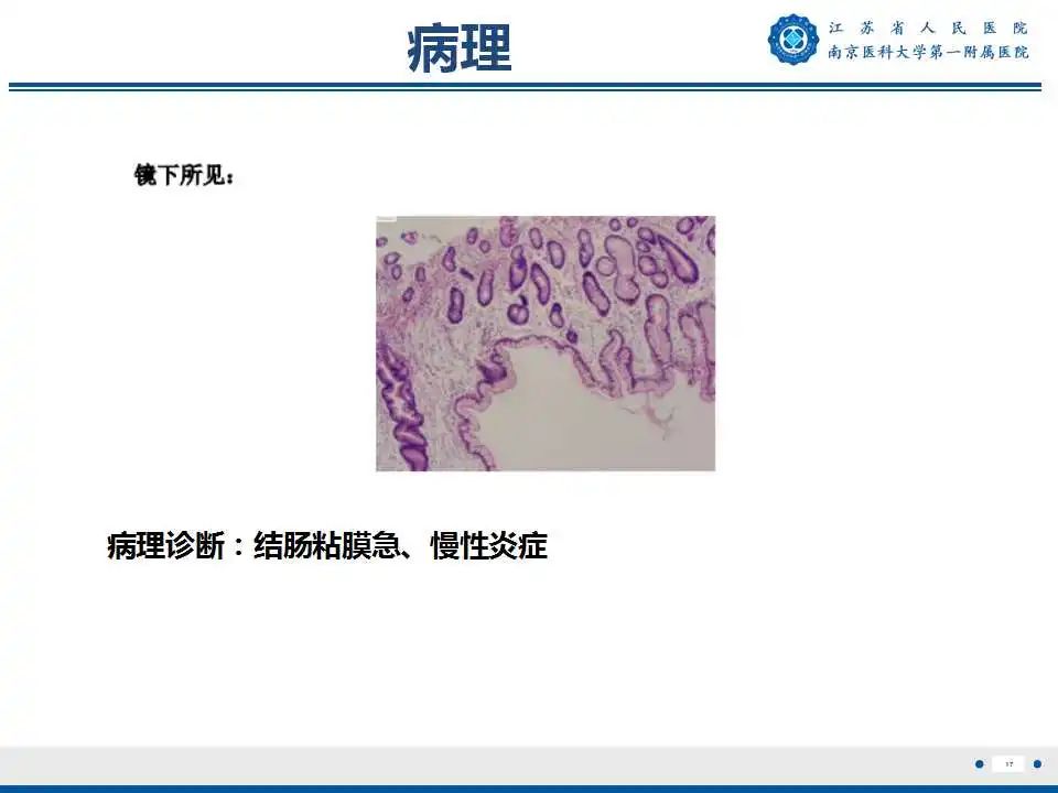 【PPT】克罗恩病-18