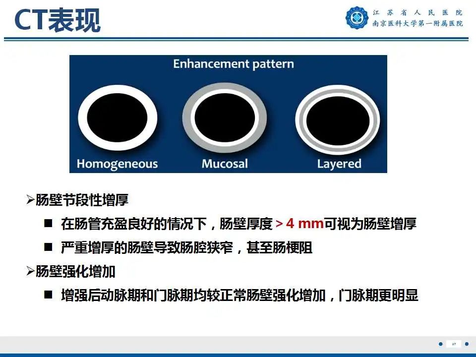 【PPT】克罗恩病-28