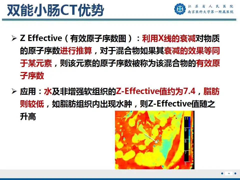 【PPT】克罗恩病-49