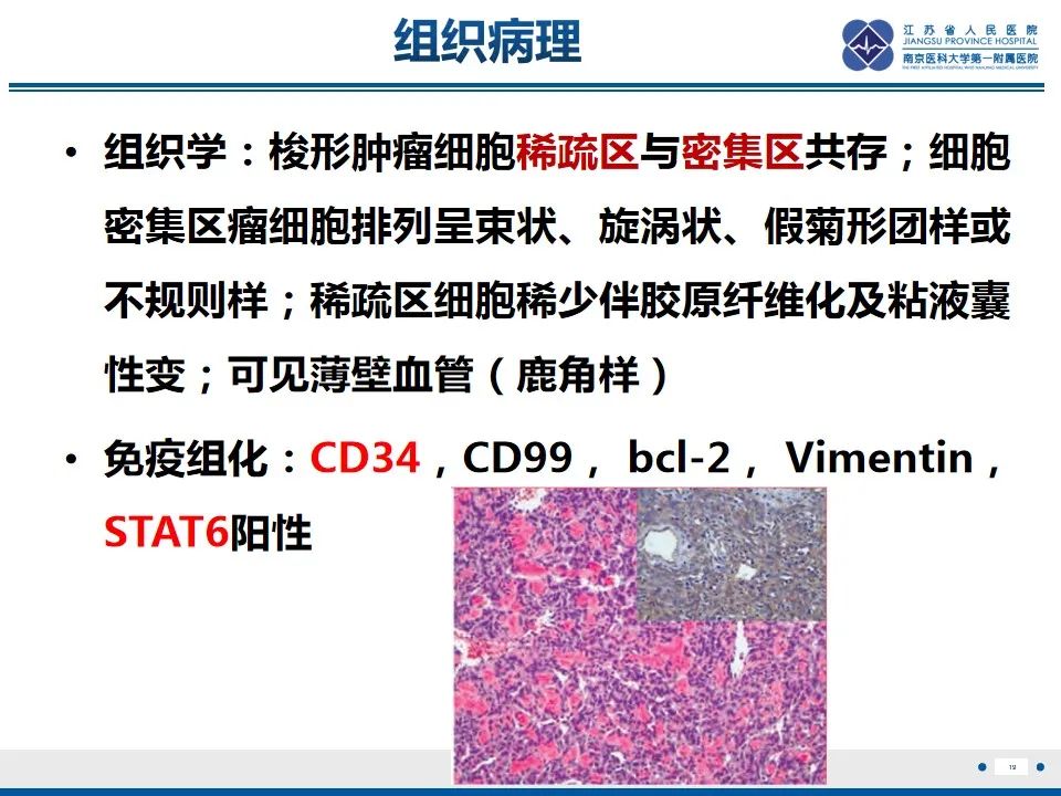 【PPT】盆腔孤立性纤维瘤-20