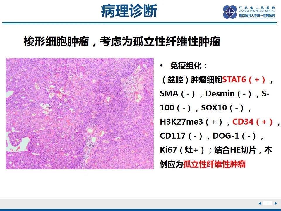 【PPT】盆腔孤立性纤维瘤-17