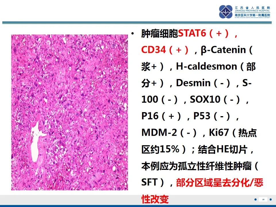 【PPT】盆腔孤立性纤维瘤-26