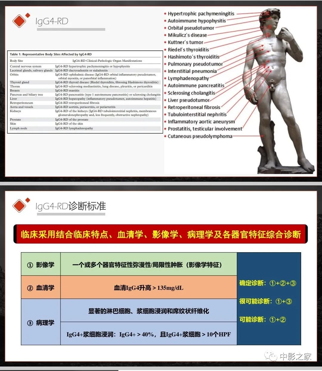 【PPT】肾脏IgG4-RD临床、病理及影像特征-5