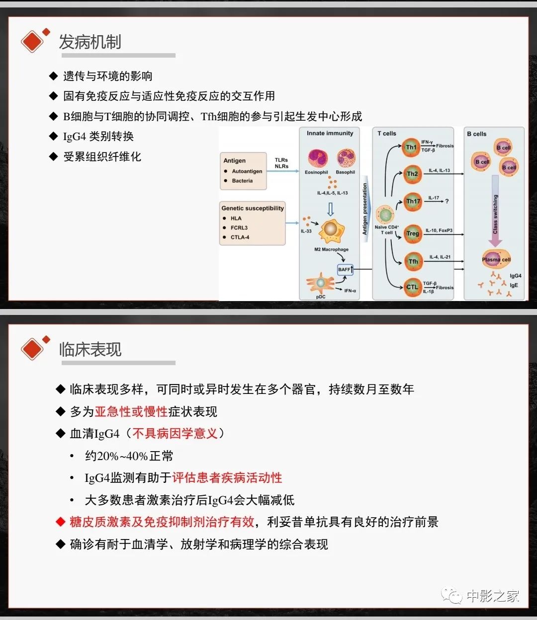 【PPT】肾脏IgG4-RD临床、病理及影像特征-4