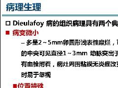 胃恒径动脉综合征