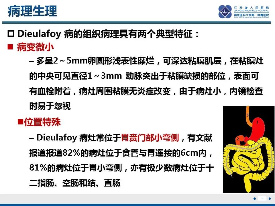 【PPT】胃恒径动脉综合征-24